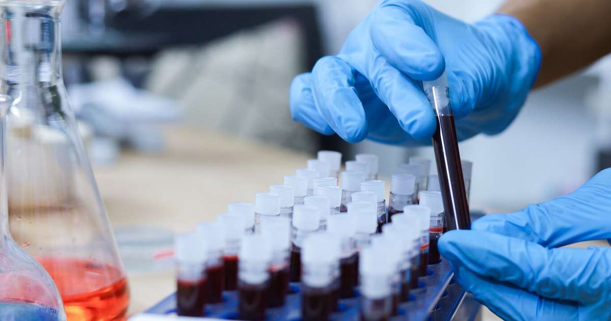 Cientistas identificam o raro tipo sanguíneo Gwada-negativo