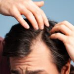 Jak příbuznost ovlivňuje naše geny: Ztráta vlasů a mateřská linie