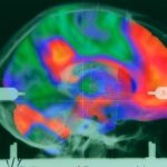 Nizozemští neurovědci otřásají novým oborem: „Základní myšlenková chyba“