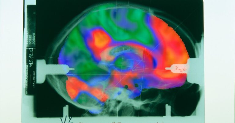 Nizozemští neurovědci otřásají novým oborem: „Základní myšlenková chyba“